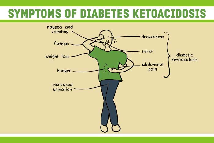 Diabeteic Ketiacidosis