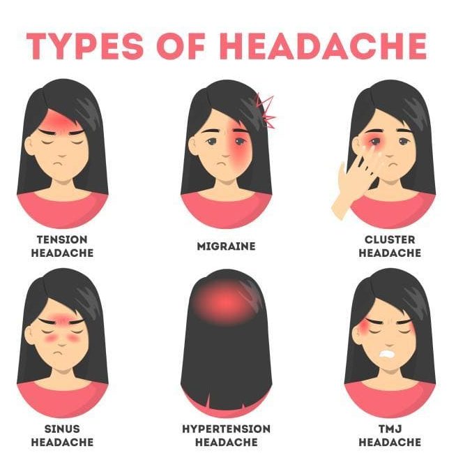 Headaches: Types, Causes and Diagnosis | When To Worry About Pain