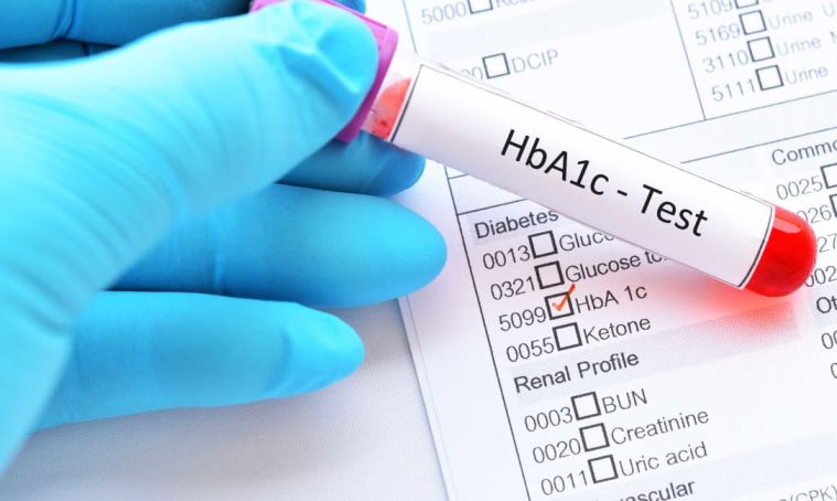 Hyperglycemia hba1c-test