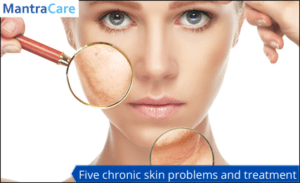 skin problems