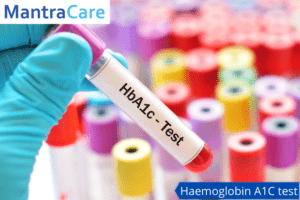 Haemoglobin A1C test