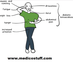 Symptoms of DKA