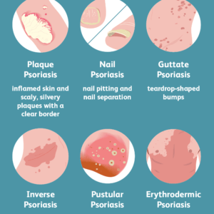 Psoriasis- skin problems