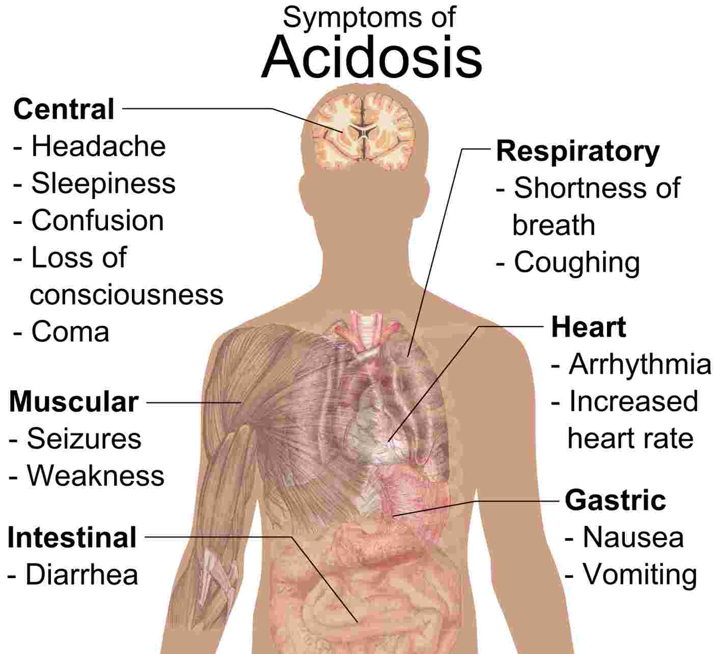 Symptoms of Acidosis