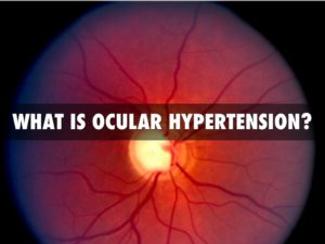 ocular hypertension