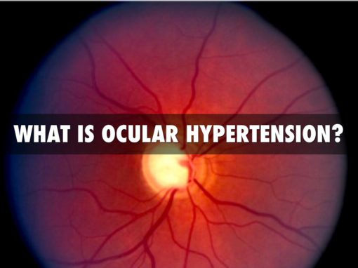 Ocular Hypertension: Causes, Symptoms, And Treatments