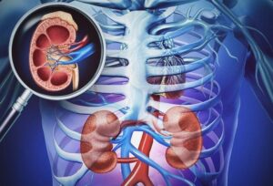 Diabetic Nephropathy
