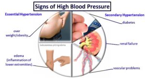 Signs of High Blood Pressure