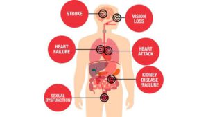 complications of high blood pressure