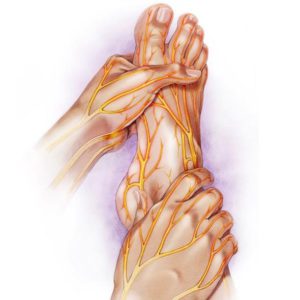 peripheral diabetic neuropathy