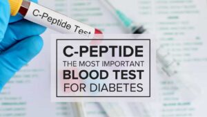 C peptide Test