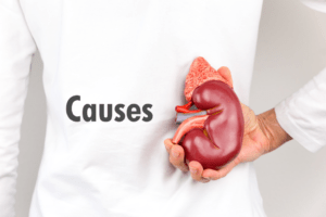  Causes of Kidney Disease