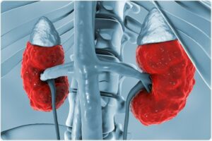 Chronic Kidney Disease