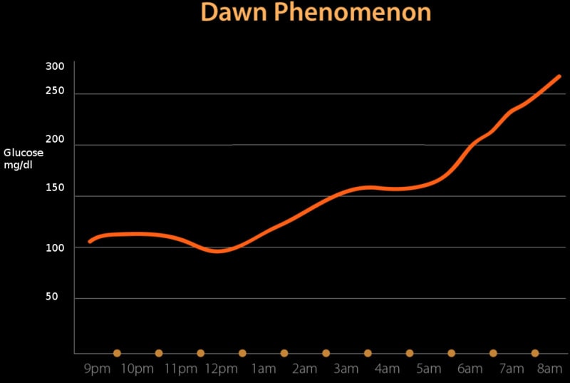 Figure, Dawn phenomenon. Image courtesy S Bhimji MD] - StatPearls - NCBI  Bookshelf