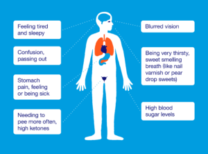 Diabetes Ketoacidos (DKA)