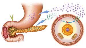 Diabetic Ketoacidosis