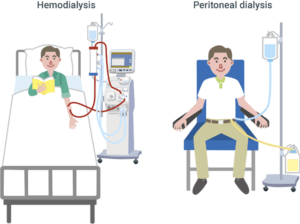 Dialysis