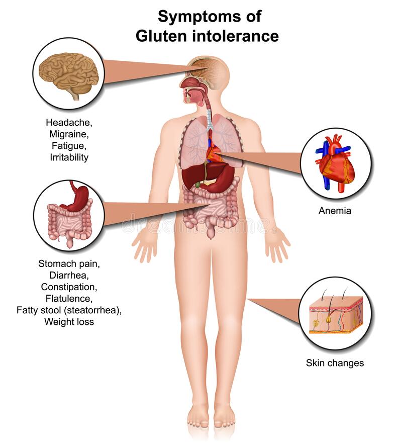 Gluten Free Diet Its Positive And Negative Impacts On Health