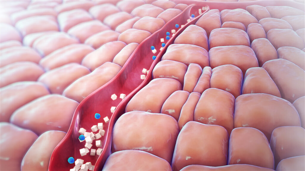 Polyphagia: Symptoms, Causes, Diagnosis, And Treatment