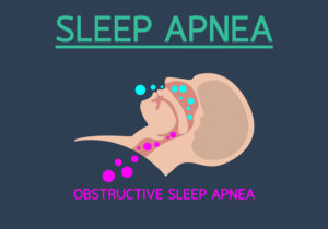 Obstructive Sleep Apnea