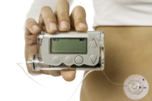 Insulin pump