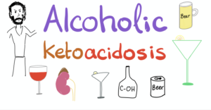 alcoholic ketoacidosis