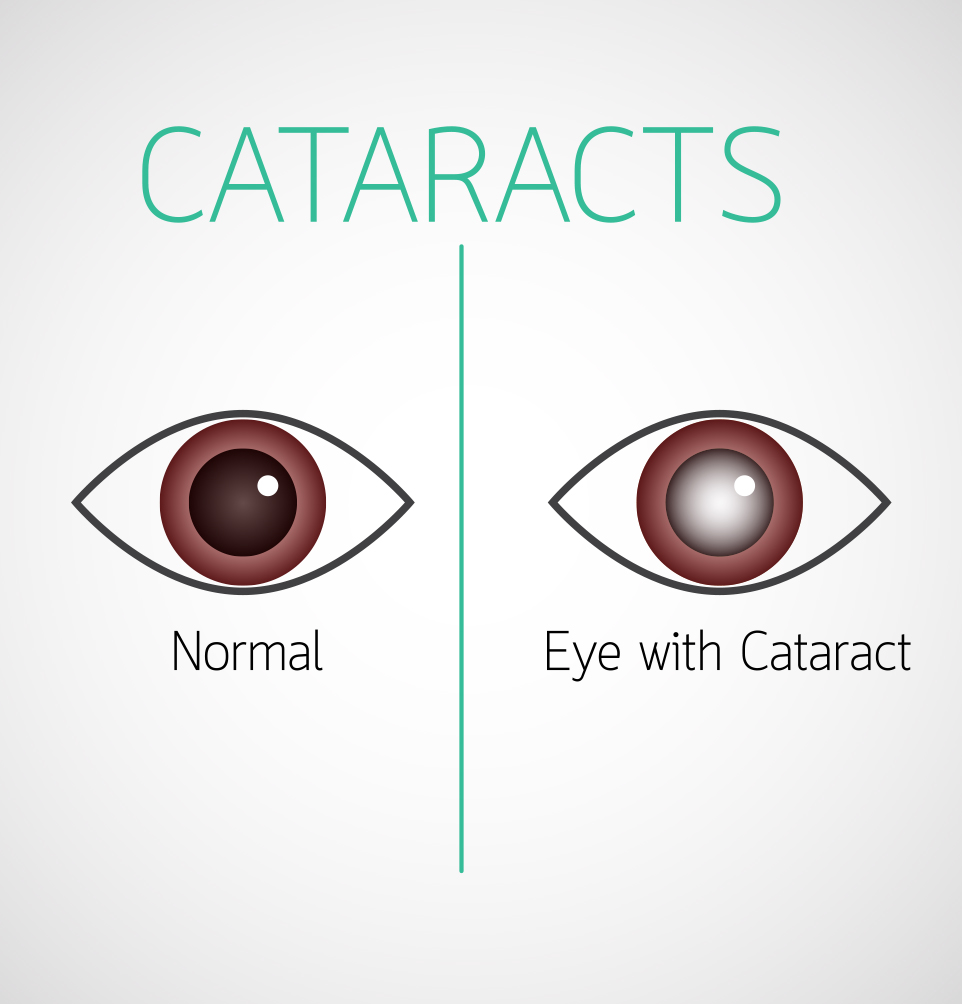 Diabetes And Eye Diseases Diabetic Retinopathy