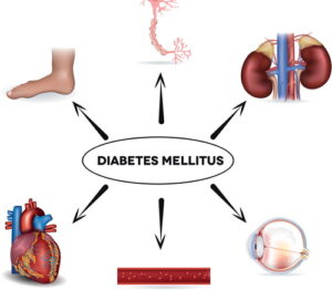 diabetes mellitus