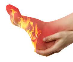 Burning sensation in Toes