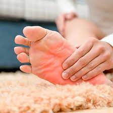 symptoms of burning toes