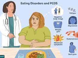 Symptoms of PCOS
