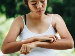 itchy skin in diabetes