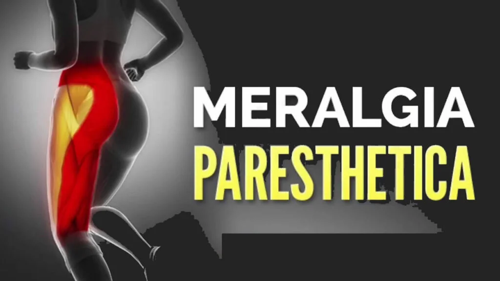 Treatment of meralgia