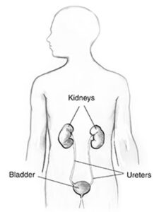 nephrogenic diabetes insipidus