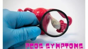PCOS symptoms