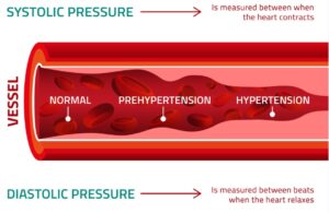 Blood Pressure readinds