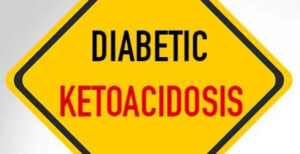 Diabetic ketoacidosis