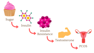 Insulin-Resistant PCOS