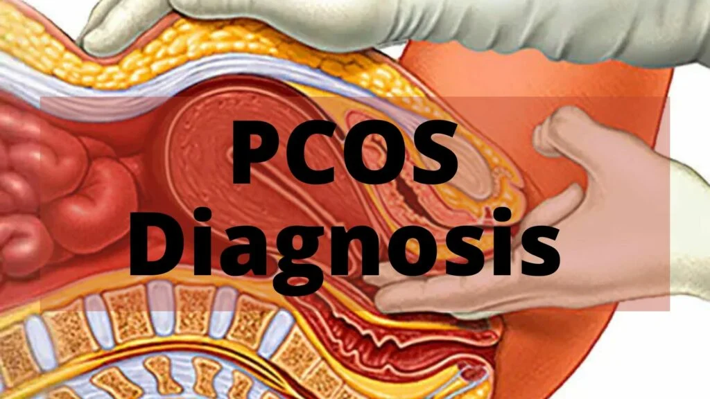 PCOS Diagnosis