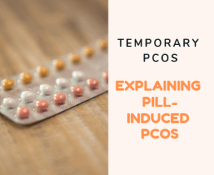 Post Pill PCOS 