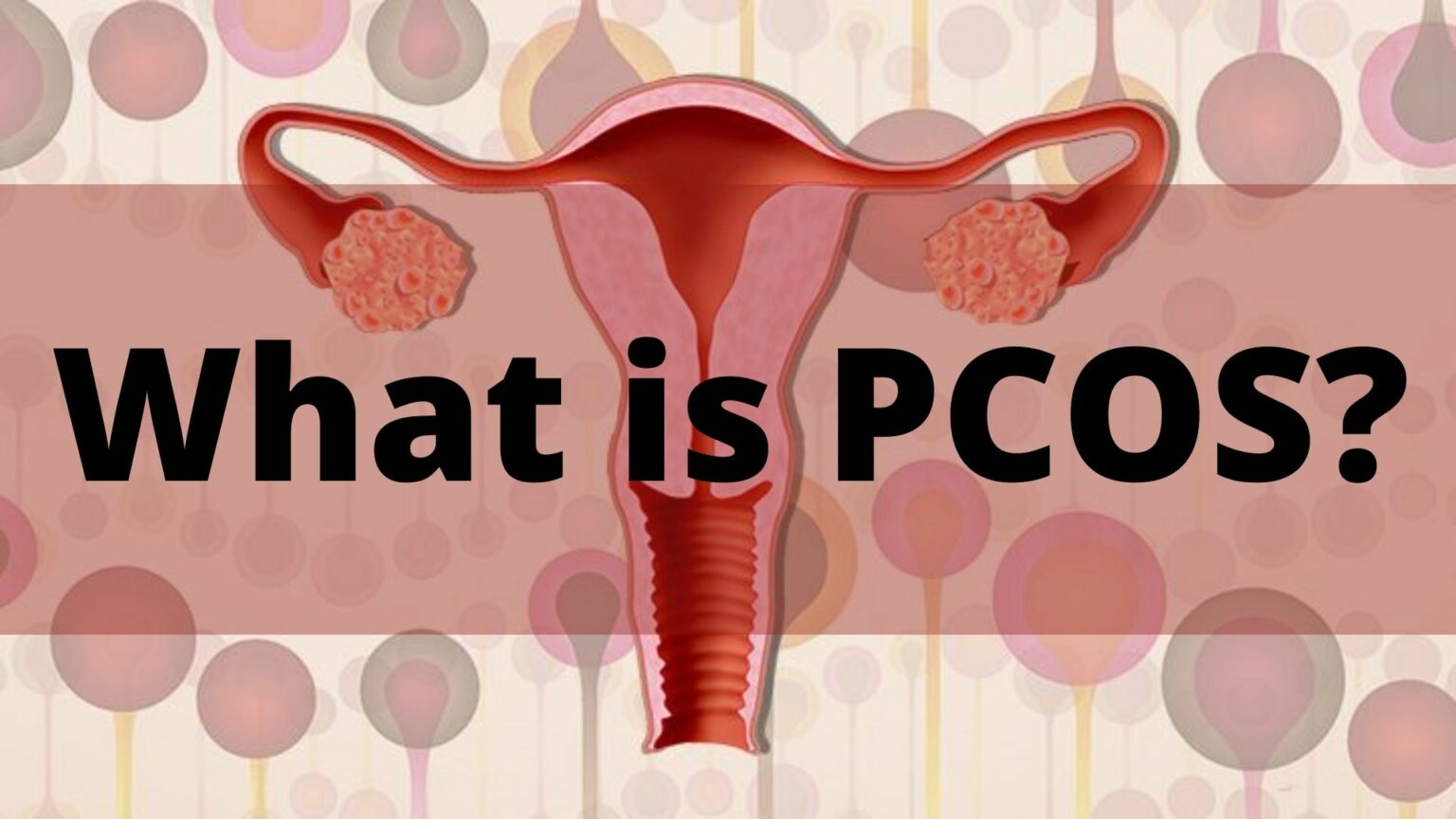 Ayurvedic Treatment For Pcos Polycystic Ovary Syndrome 4145