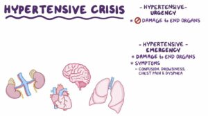 hypertensive crisis complication of hypertension