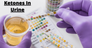 Ketones in Urine