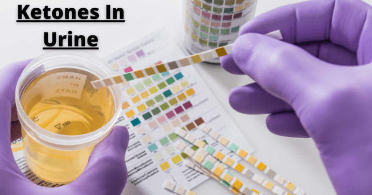 ketones-in-urine-causes-diagnosis-and-treatment-2023