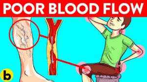 poor blood flow