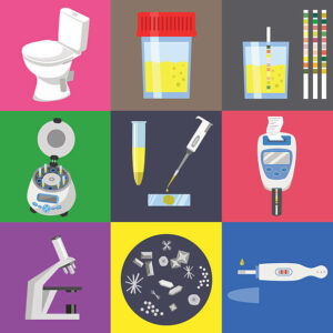 steps of ketone in urine test