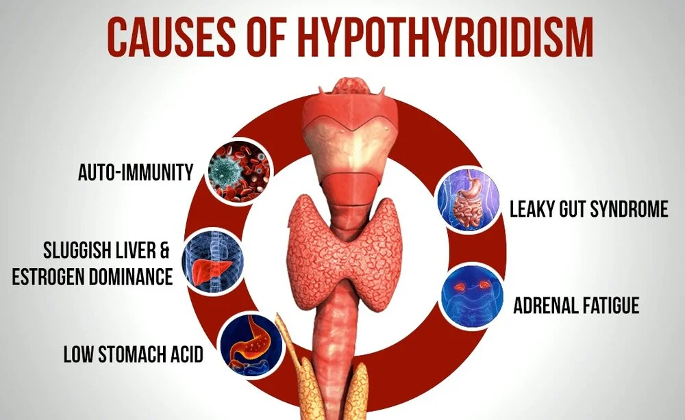 How Can Hypothyroidism Affect Fertility