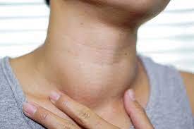 Swelling In The Neck