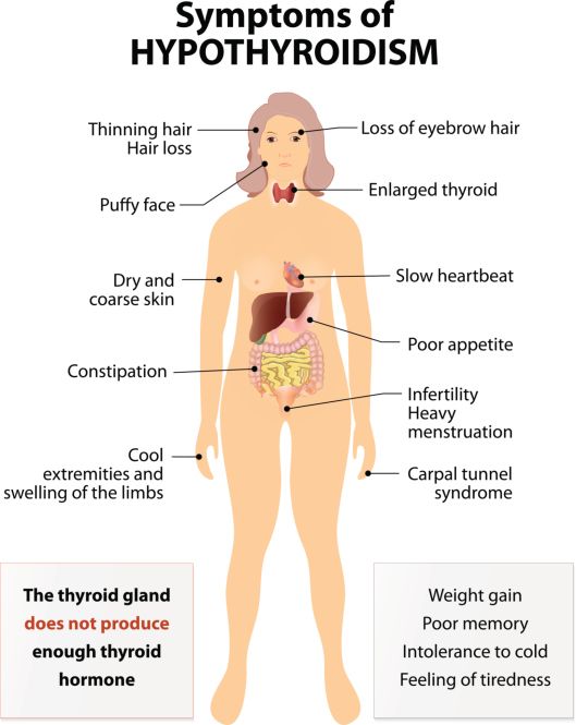 Symptoms Of Hypothyroidism