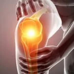 Knee Pain